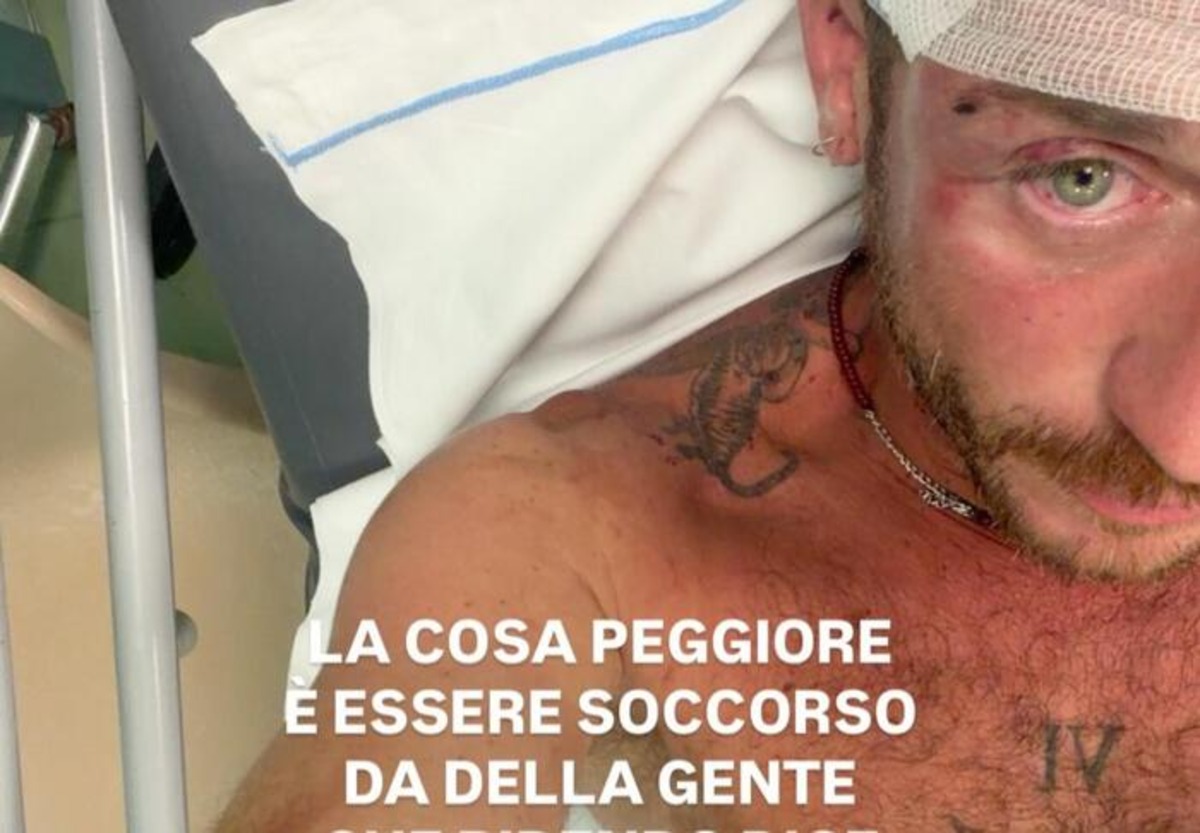 Olbia, picchiato perché gay da 30 persone: la denuncia di un promoter milanese, partite le indagini Olbia, picchiato perché gay da 30 persone: la denuncia di un promoter milanese, partite le indagini