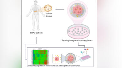 Tumore al pancreas, sensori “smart” misurano la risposta alla chemio: lo studio parte dal Salento