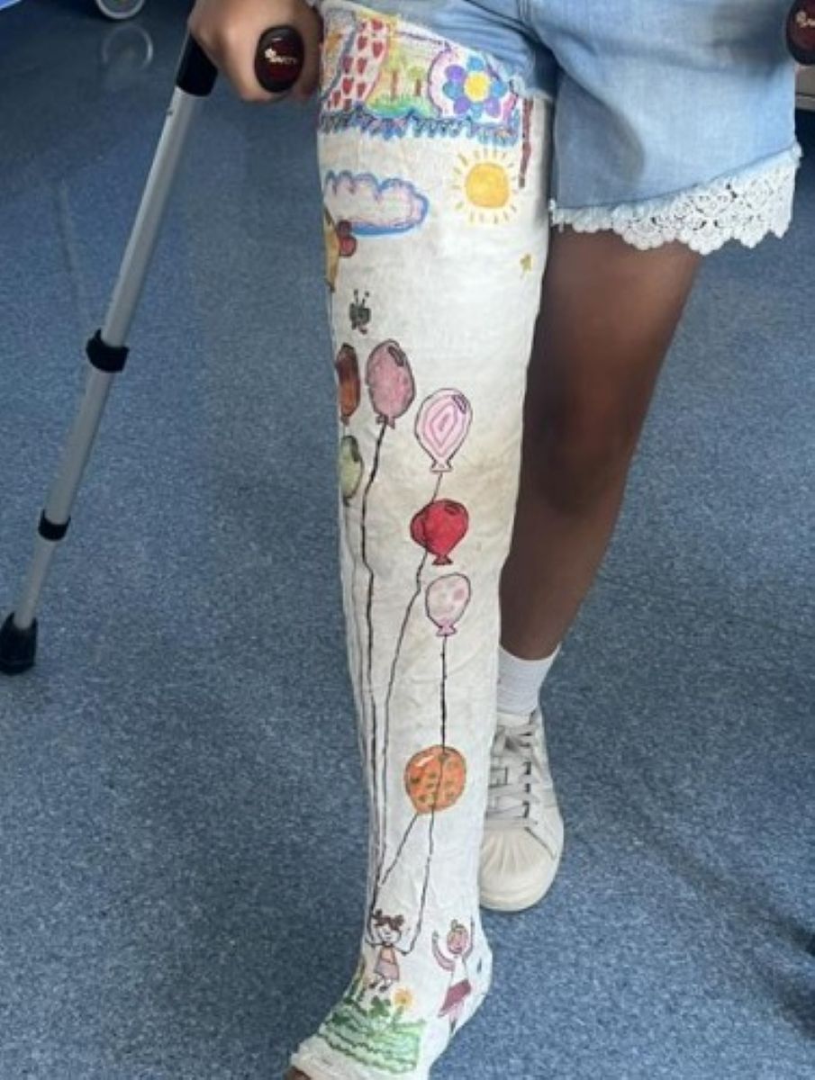 Bari, i gessi dei bimbi diventano piccole opere d’arte: premiati i vincitori del concorso del Pediatrico – FOTO